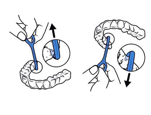 Aligner Removal Tool