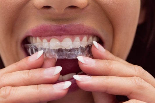 Pro Tips to Maintain Good Oral Hygiene With Invisalign